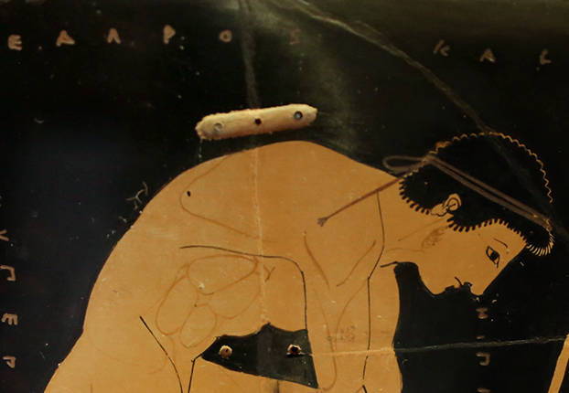Euphronios, Sarpedon Krater, (signed by Euxitheos as potter and Euphronios as painter), detail showing repair, c. 515 B.C.E., red-figure terracotta, 55.1 cm diameter (National Museum Cerite, Cerveteri, Italy, photo: Sailko, CC BY 3.0)