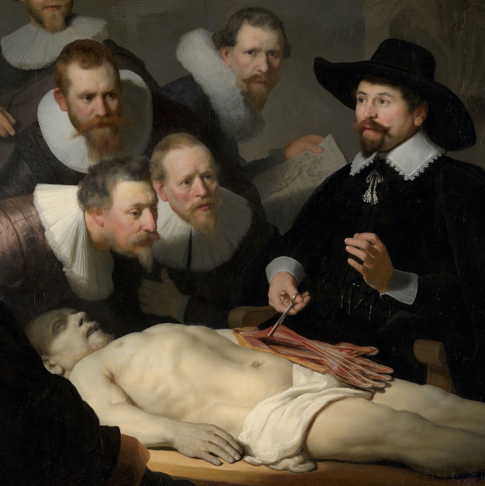 Dr. Tulp displaying the flexors in a cadaver's arm (detail), Rembrandt van Rijn, The Anatomy Lesson of Dr. Tulp, 1632, oil on canvas, 169.5 x 216.5 cm (Mauritshuis, The Hague, Netherlands)